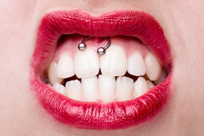 How To Treat An Infected Smiley Piercing Inkedmind